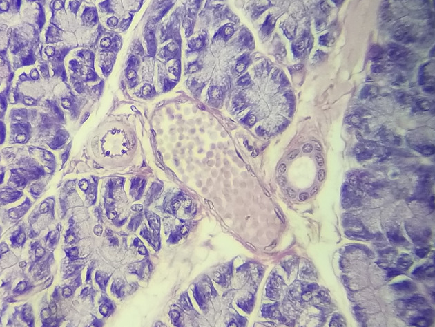 Pancreas Slides - Pancreas 013 400X